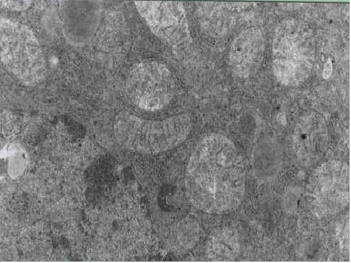 fig. 1 - Hepatocito de hgado de rata control. Se observa la estructura nuclear de aspecto normal, retculo endoplasmtico rugoso con canales estrechos y mitocondrias bien conservadas 12 000 X